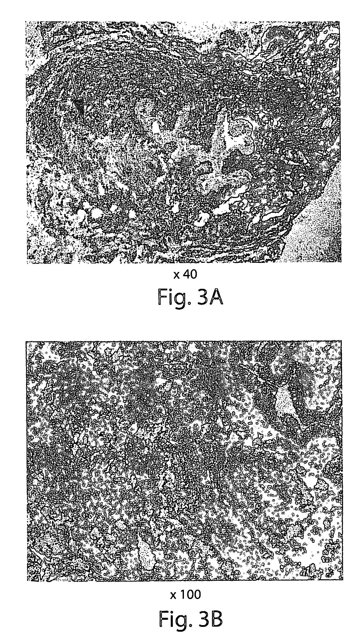 Muscle derived cells for the treatment of cardiac pathologies and methods of making and using the same
