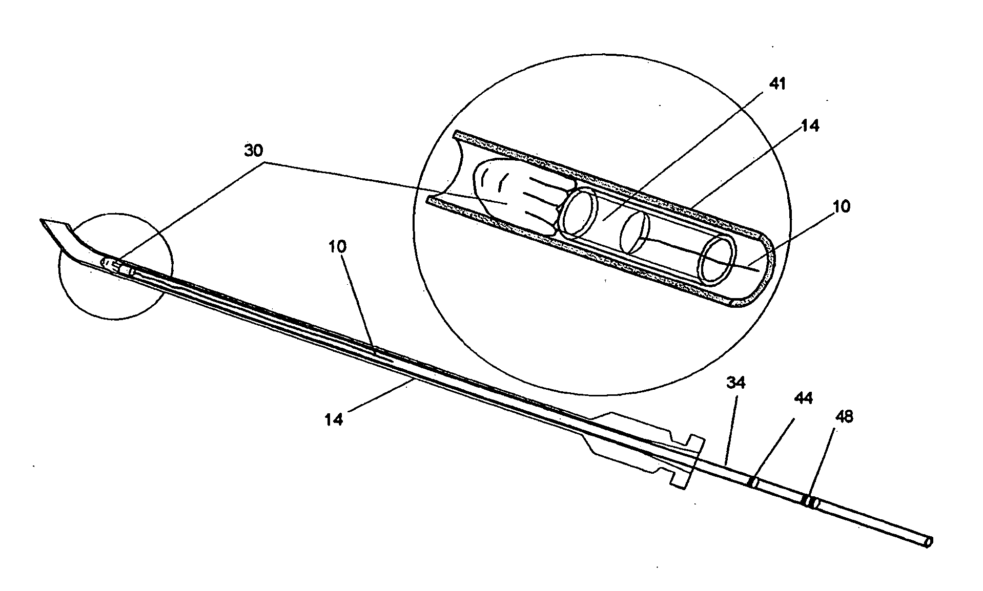 Methods and devices for treating dural puncture