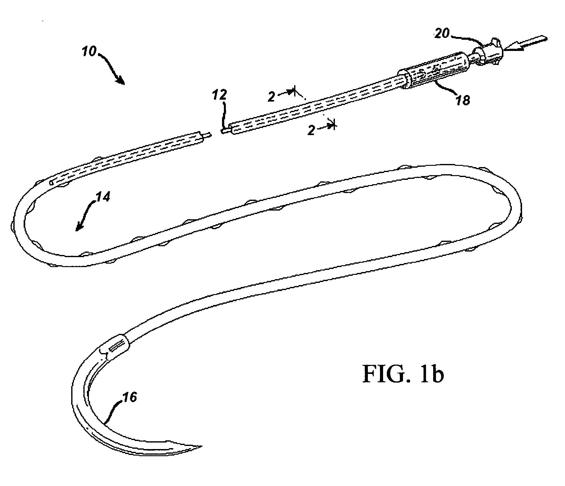 Active suture for the delivery of therapeutic fluids