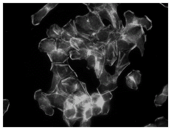 Application of chlorothiazide in preparing medicament for inhibiting tumor cell metastasis and diffusion