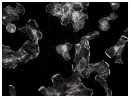 Application of chlorothiazide in preparing medicament for inhibiting tumor cell metastasis and diffusion