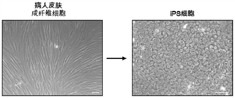 Liver organoid model, establishment method and application thereof, and pharmaceutical composition for treating hepatocyte ferroptosis