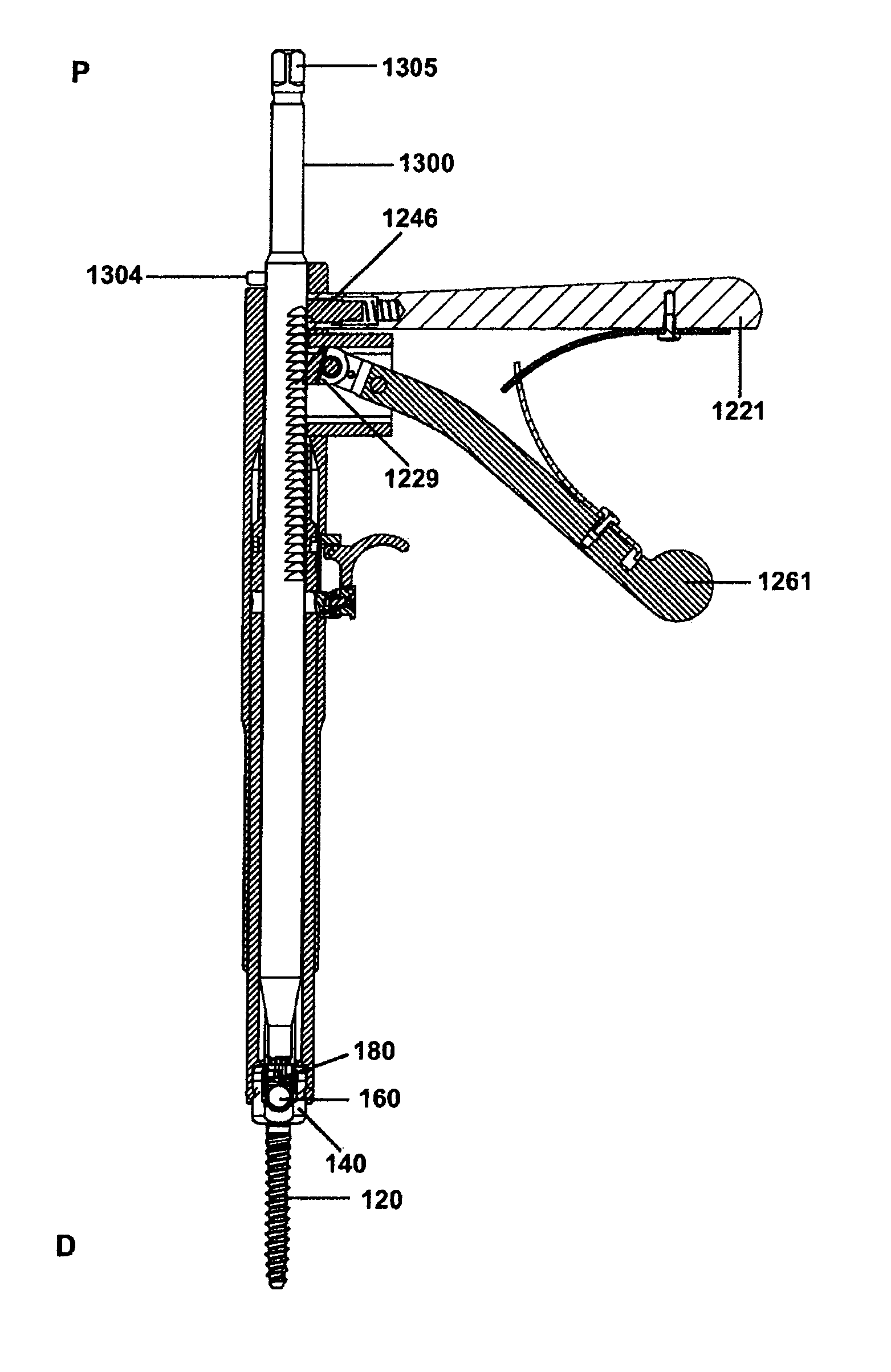 Spinal rod and screw securing apparatus and method