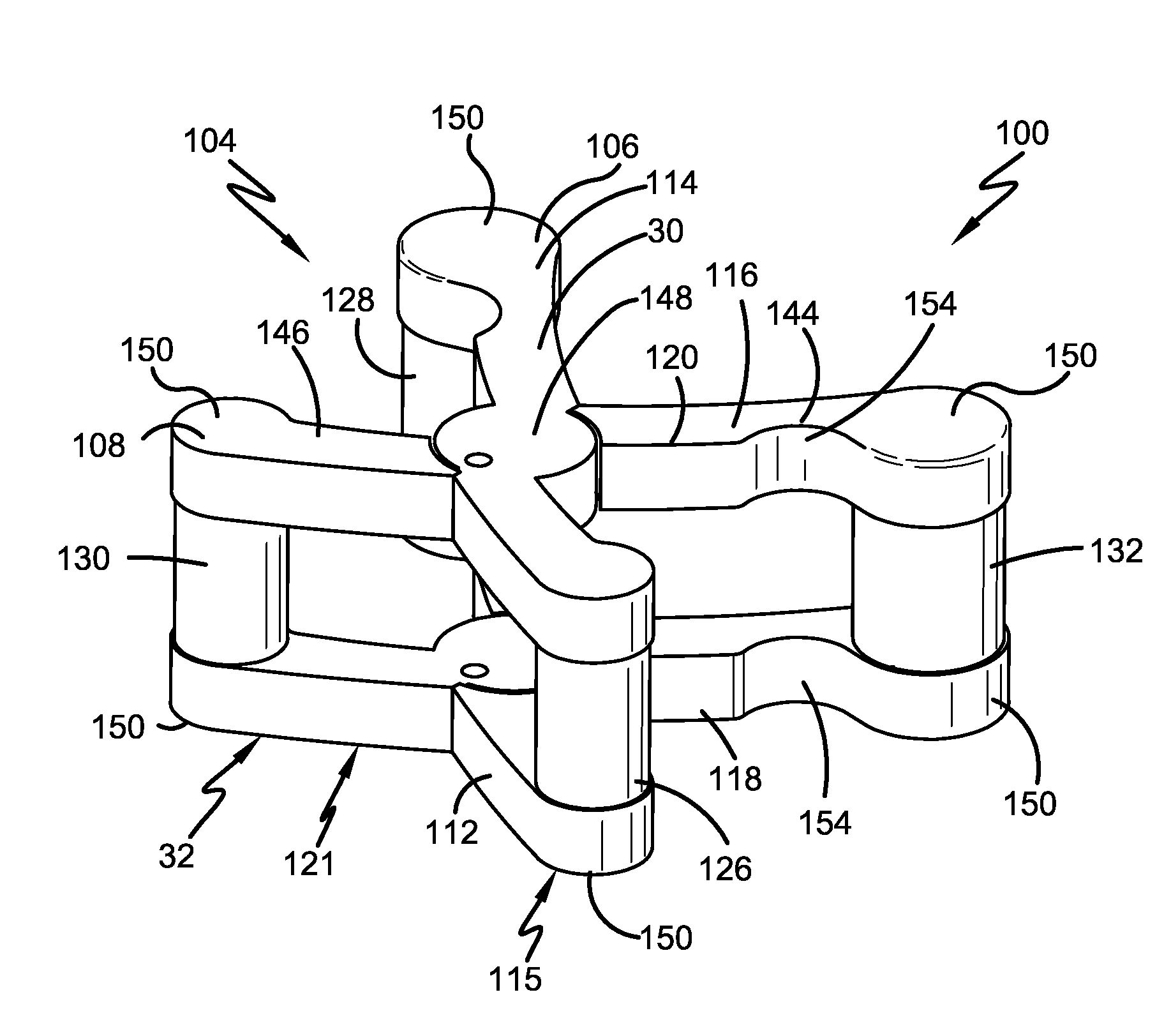 Spine surgery method and implant