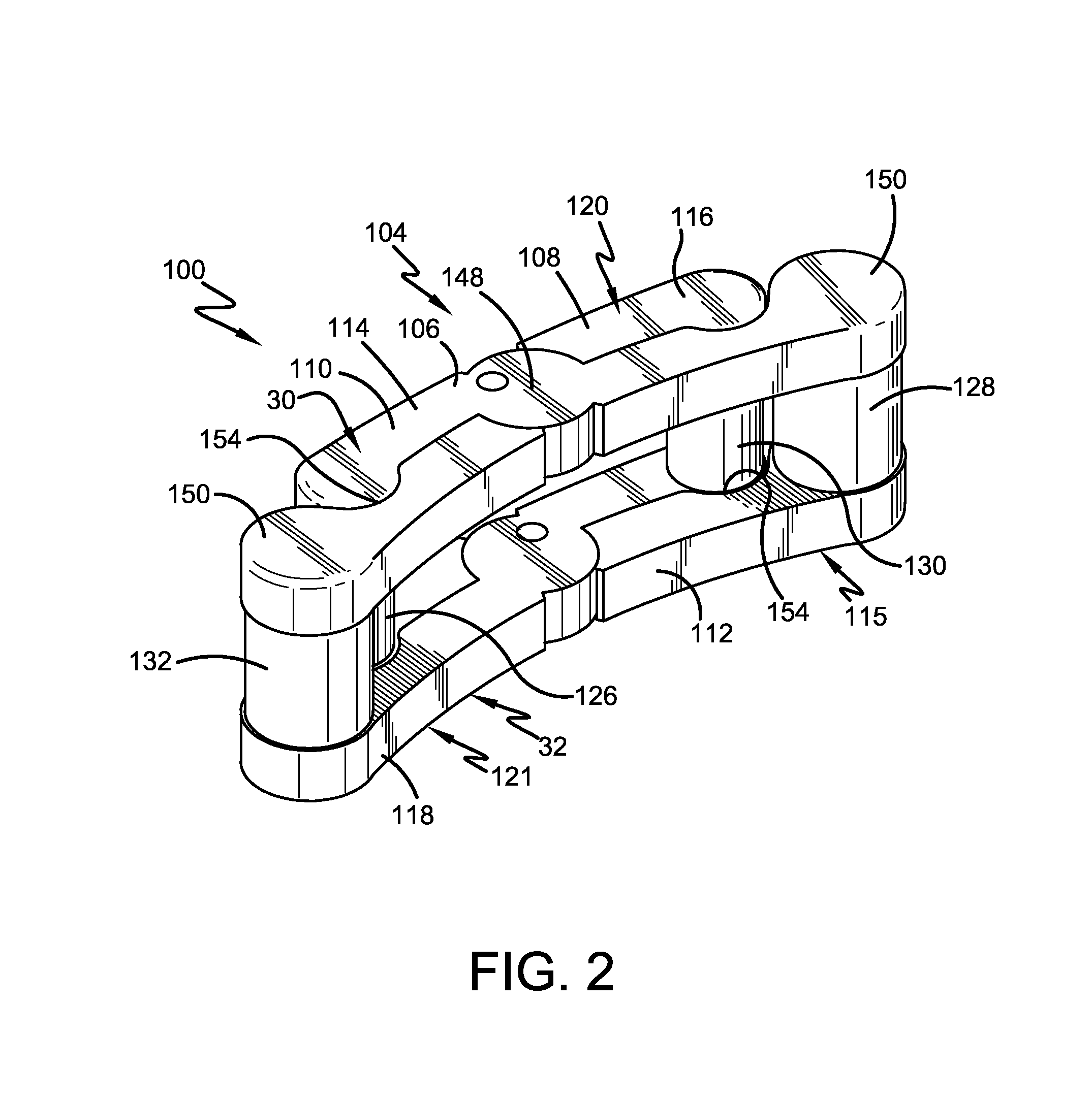 Spine surgery method and implant