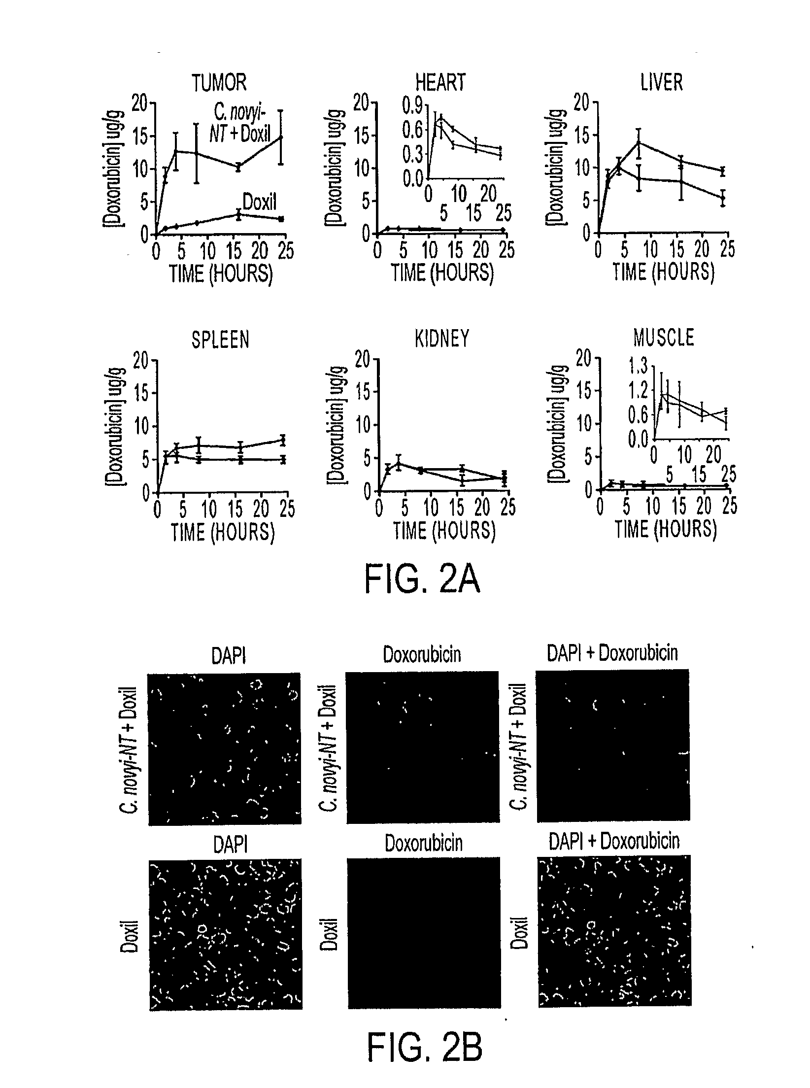 Tumor-specific delivery of therapeutic agents via liposomase