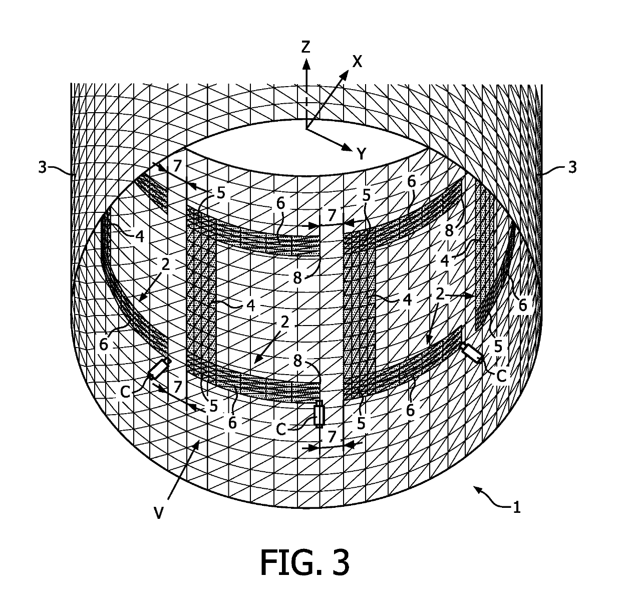 Transverse-electromagnetic (TEM) radio-frequency coil for magnetic resonance