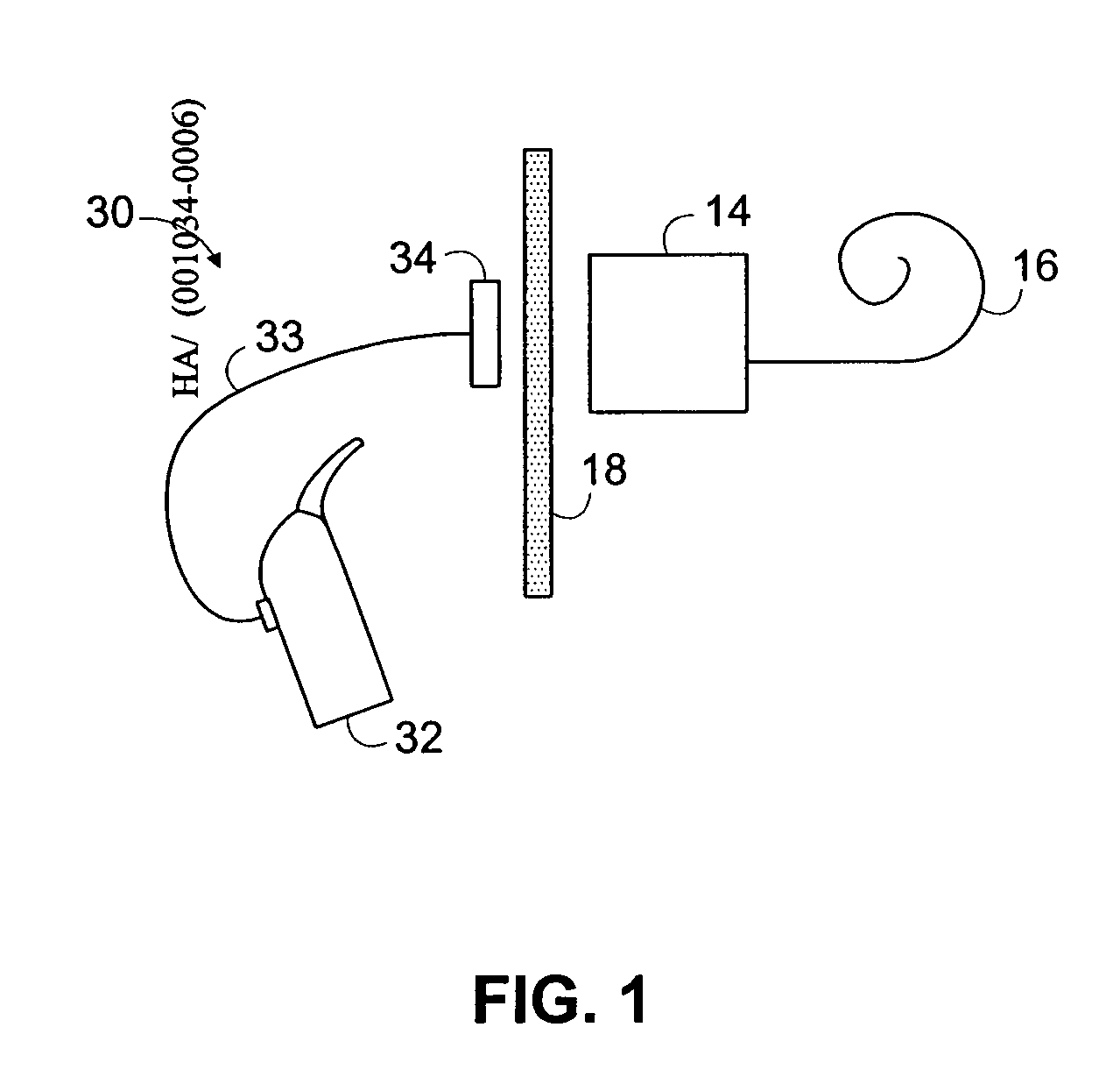 Sound processing and stimulation systems and methods for use with cochlear implant devices