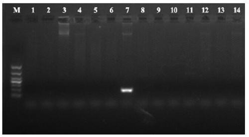 Real-time fluorescence quantitative PCR detection kit for deformed pseudomonas plecoglossicida TaqMan and preparation method thereof