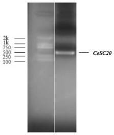 A kind of casuarina gene cesc20 and its application