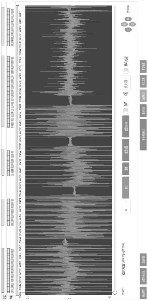 Heart sound analysis and labeling method and system