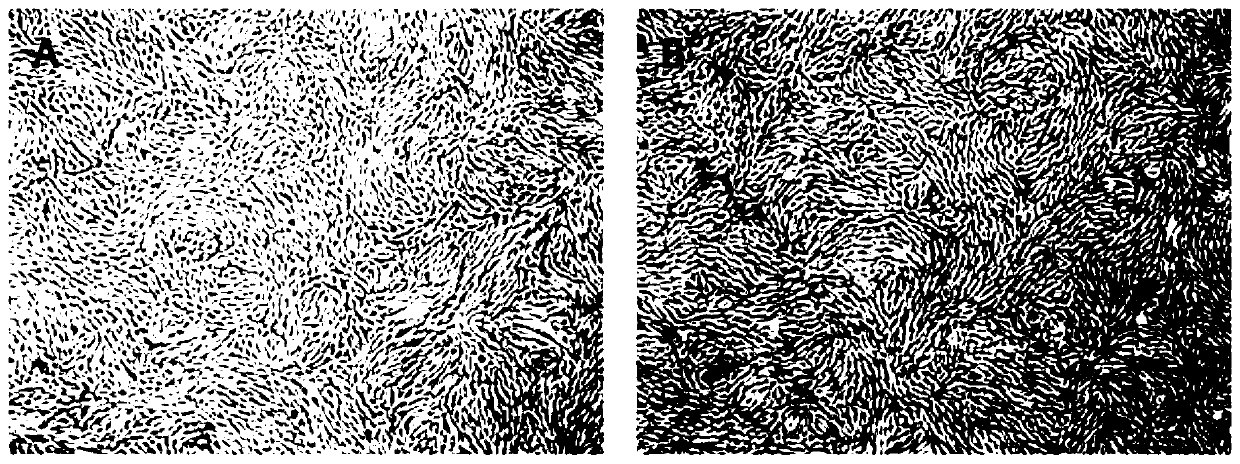 A kind of preparation method of human mesenchymal stem cell freeze-dried powder