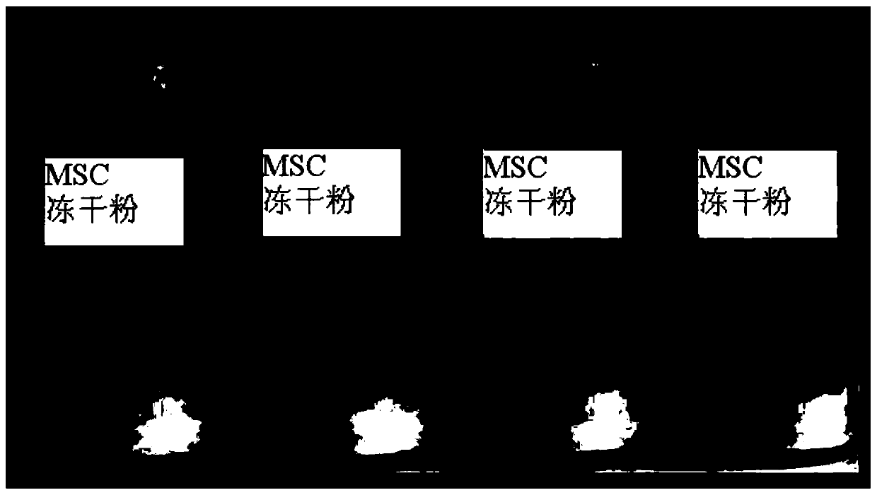 A kind of preparation method of human mesenchymal stem cell freeze-dried powder