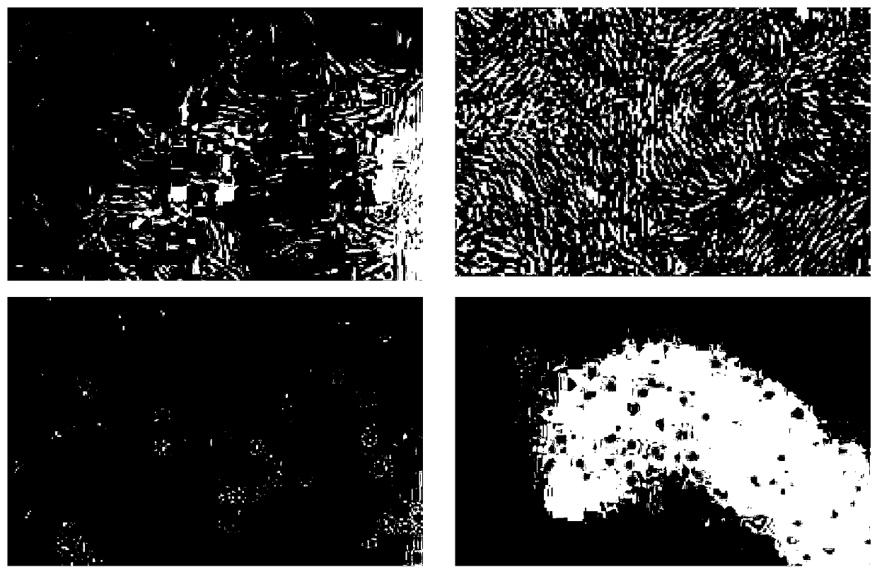 A kind of preparation method of human mesenchymal stem cell freeze-dried powder