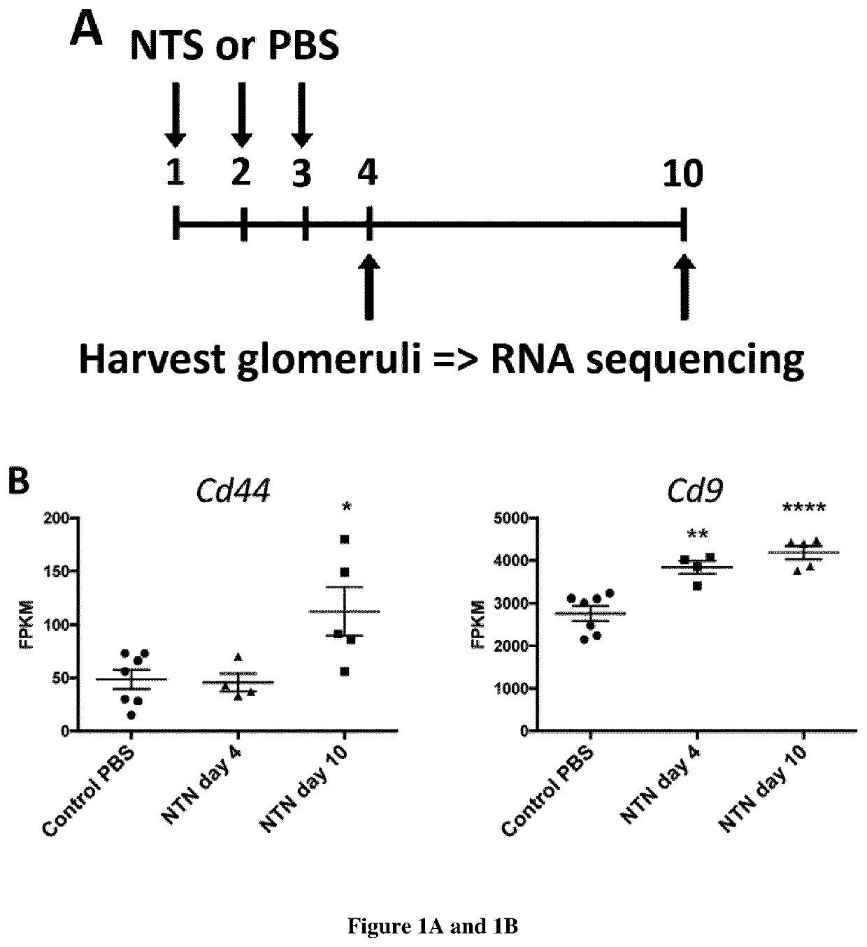 Use of cd9 as a biomarker and as a biotarget in glomerulonephritis or glomerulosclerosis