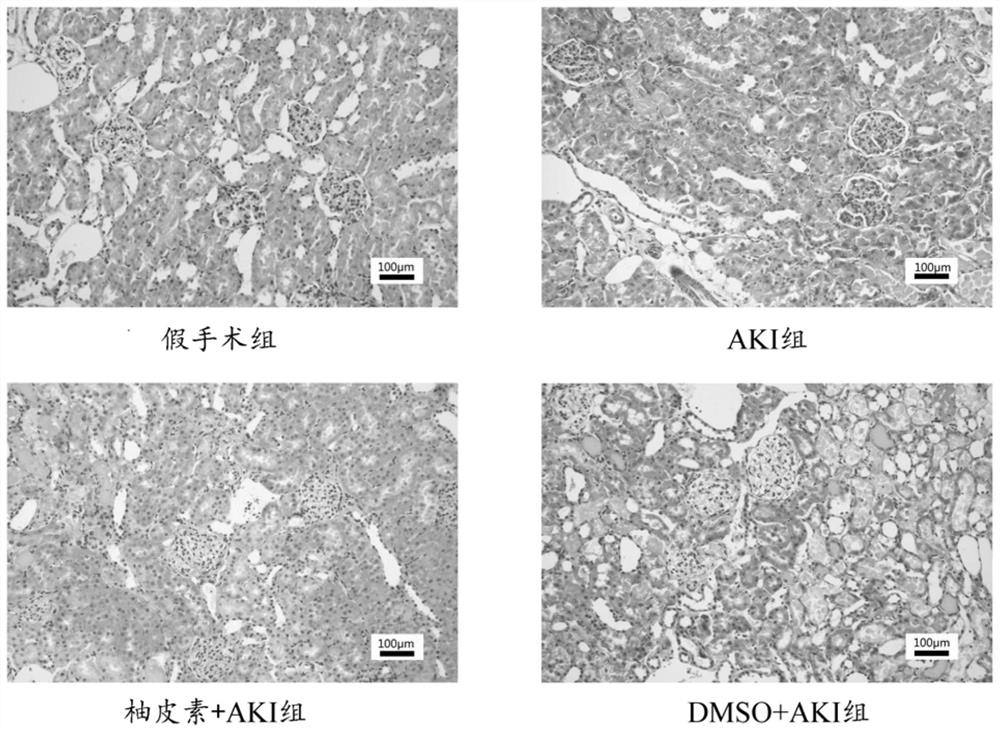 Application of naringenin in preparation/protection of renal ischemia reperfusion injury through relieving of renal inflammatory response