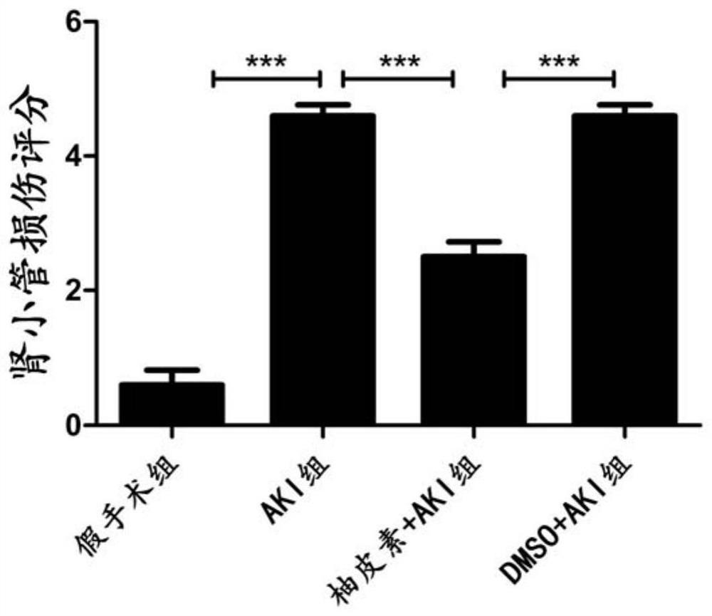Application of naringenin in preparation/protection of renal ischemia reperfusion injury through relieving of renal inflammatory response
