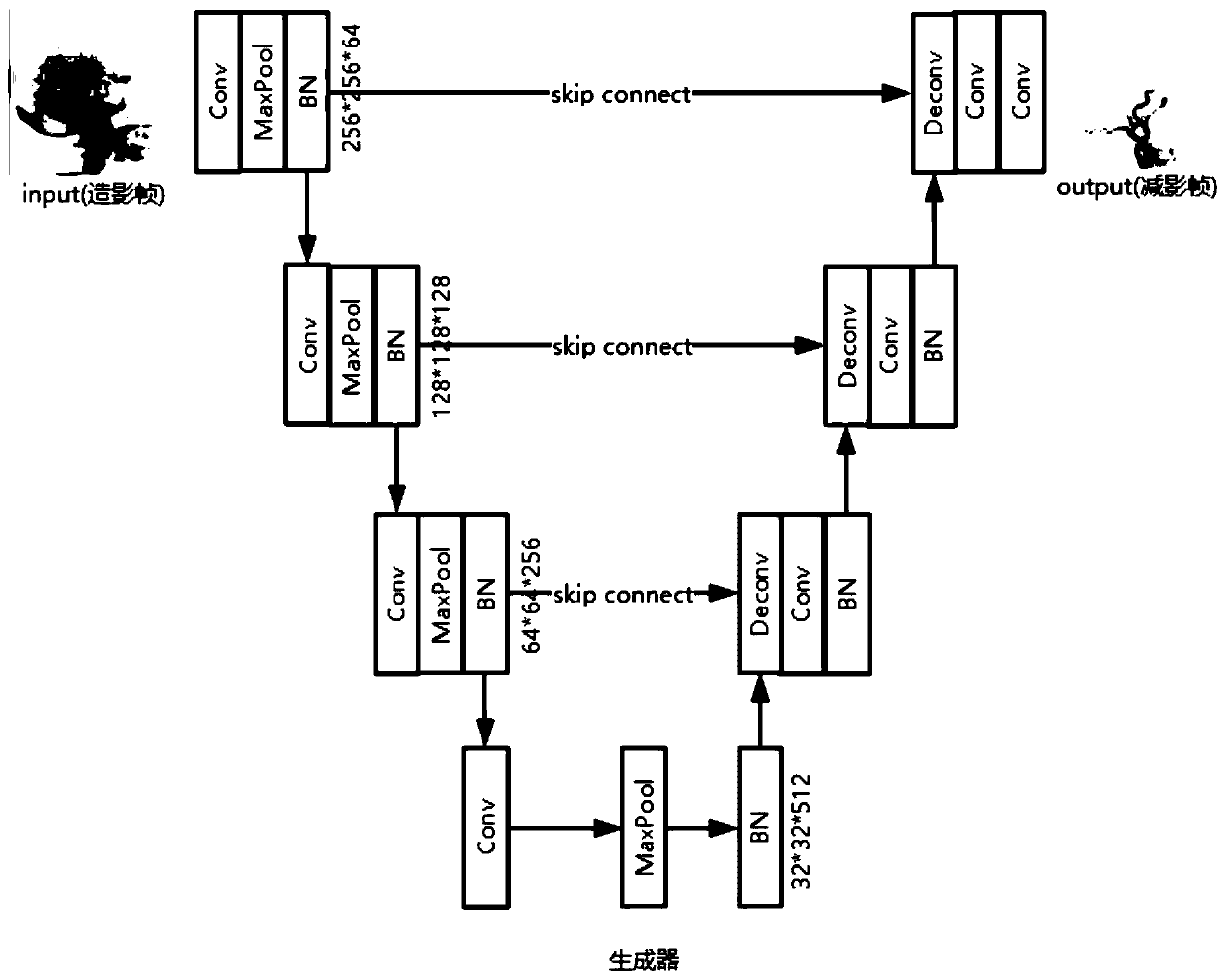 U-net based generation adversarial network DSA imaging method and device