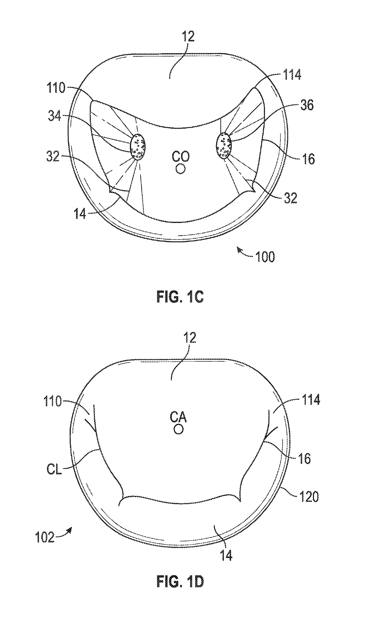 Systems and methods for anchoring an implant