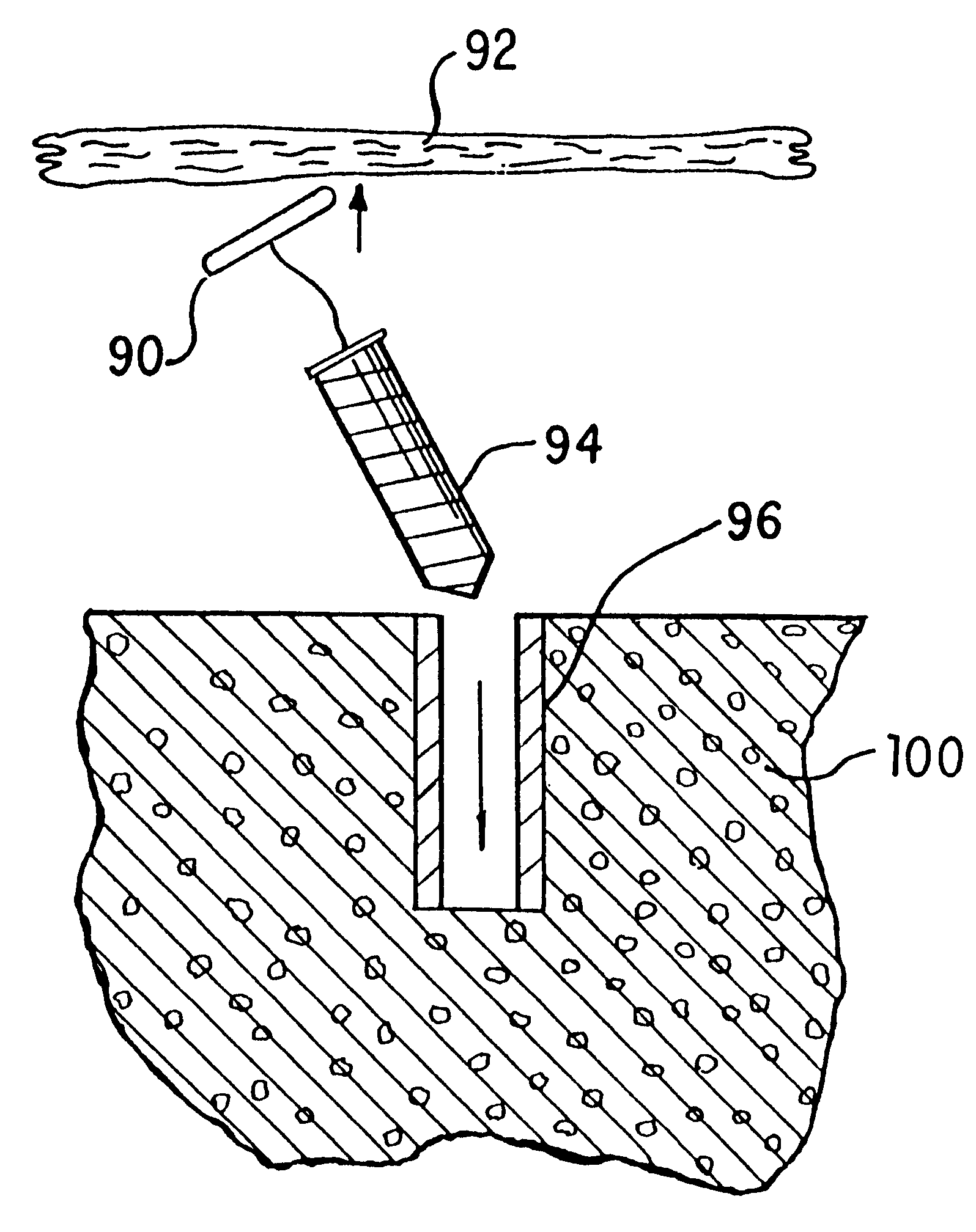 Knotless suture anchor assembly