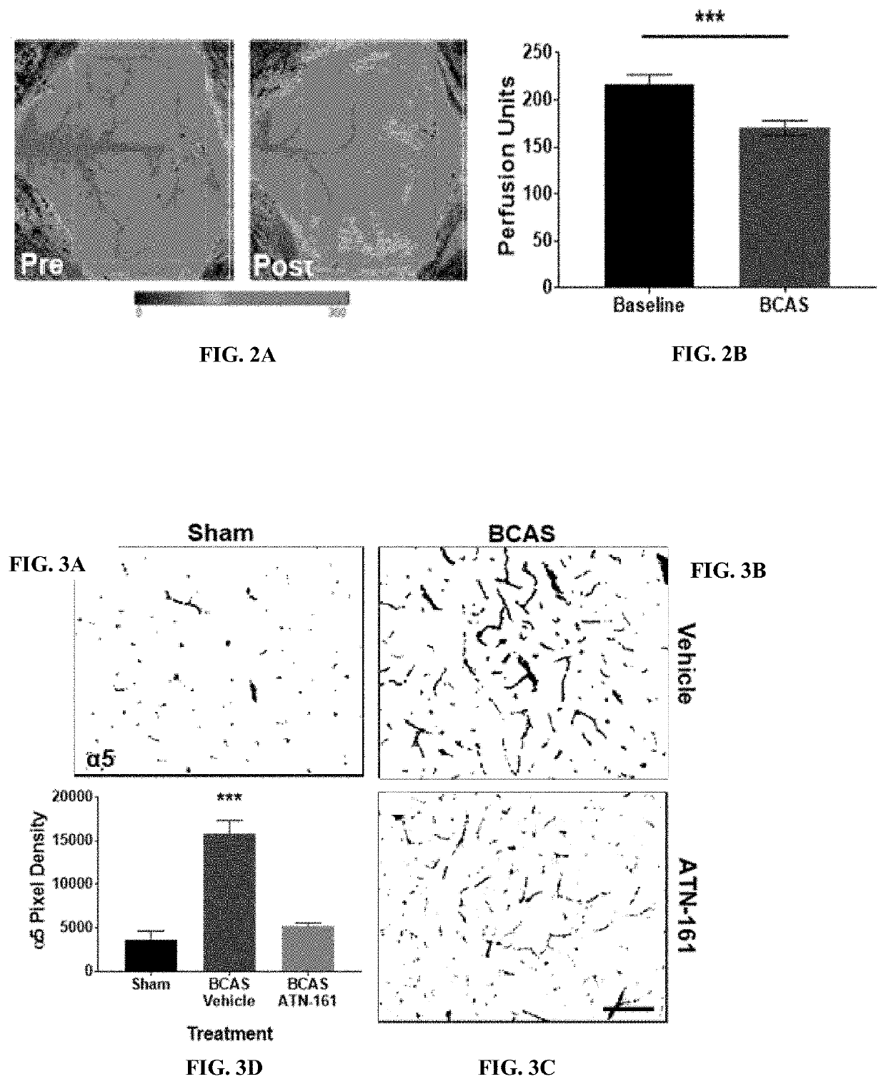 Inhibition of alpha5beta1 integrin with atn-161 as a novel therapy for vascular dementia