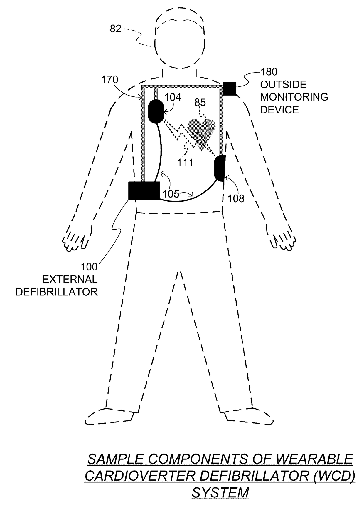 Wearable cardioverter defibrillator (WCD) causing patient's qrs width to be plotted against the heart rate