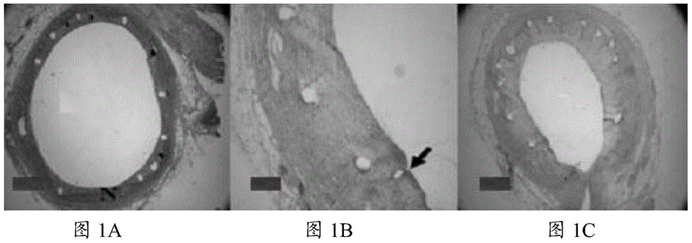 A kind of medicine for preventing and treating restenosis and its preparation and use method