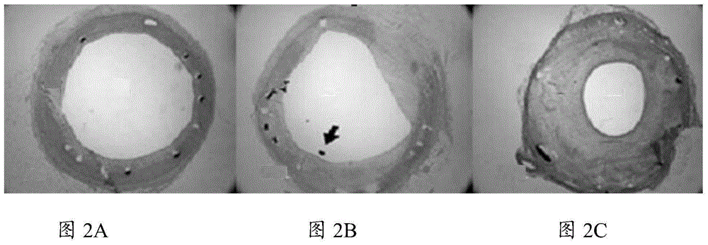 A kind of medicine for preventing and treating restenosis and its preparation and use method