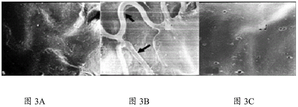 A kind of medicine for preventing and treating restenosis and its preparation and use method