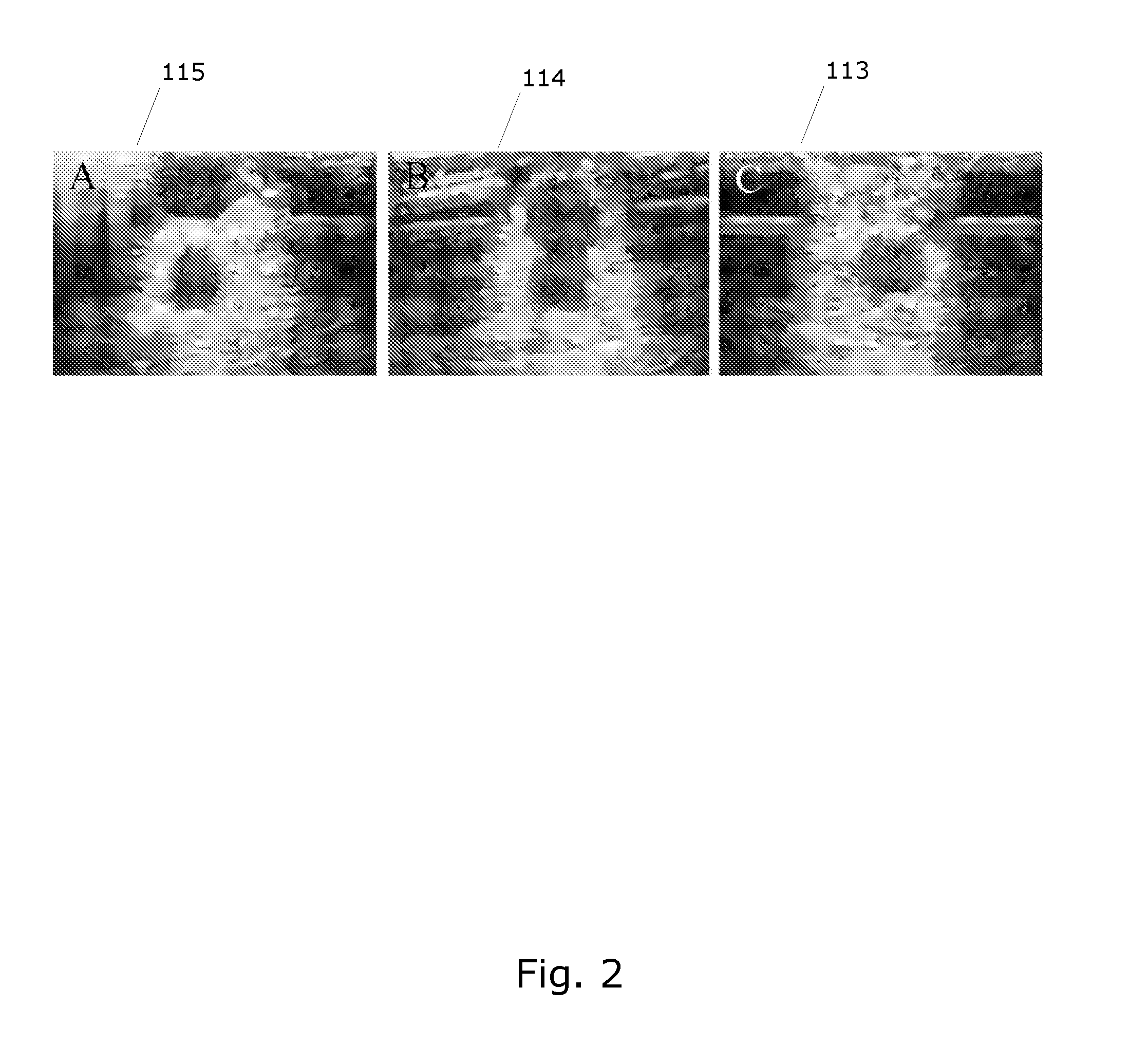 System for determining flow properties of a blood vessel