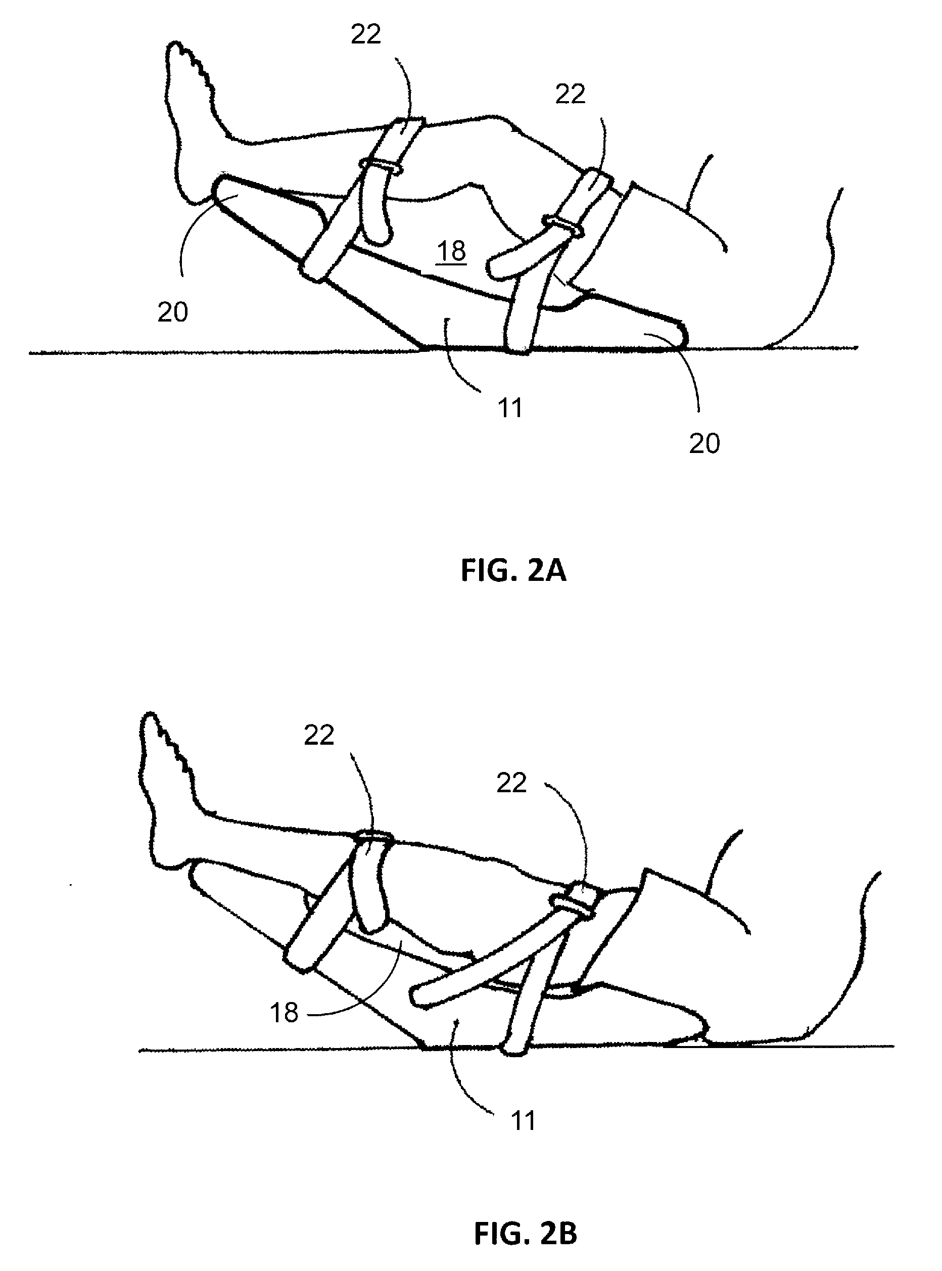 Methods and Devices for Treating Pathological Conditions of the Human Knee