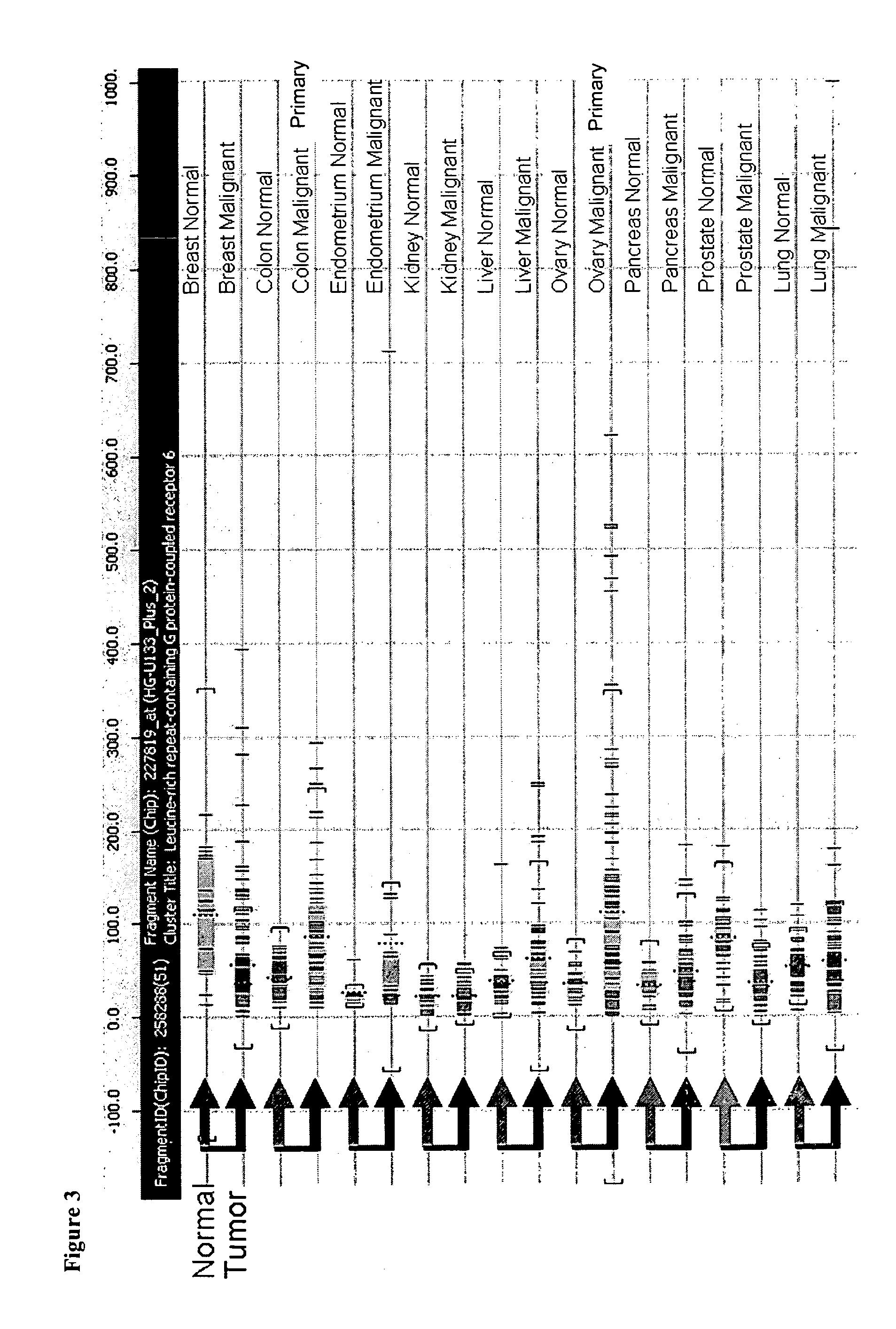 Compositions and Methods for Treating and Diagnosing Cancer