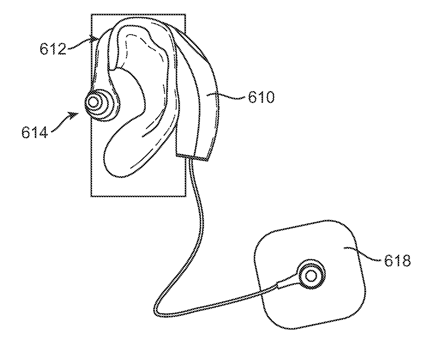 Systems and methods for anesthetizing ear tissue