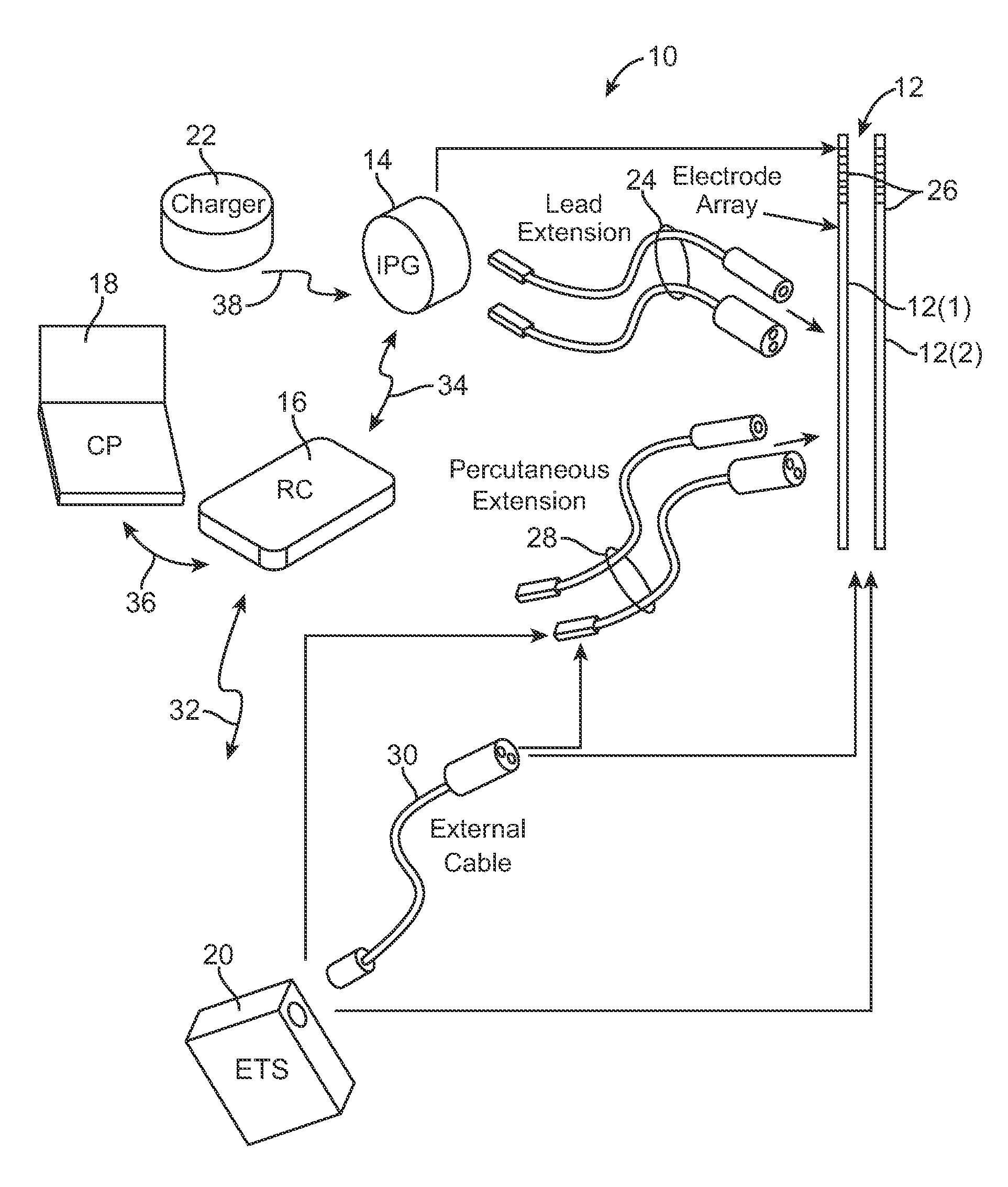 Method and apparatus for determining relative positioning between neurostimulation leads