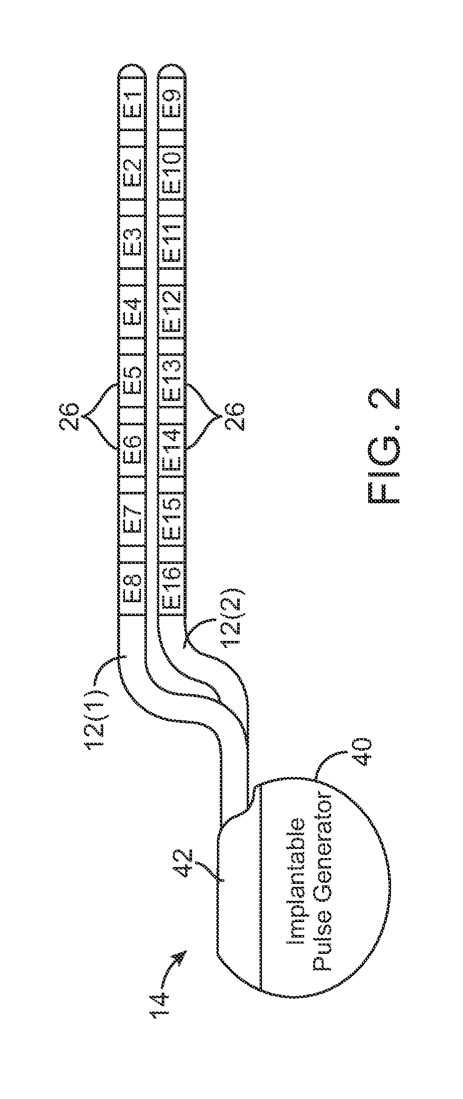 Method and apparatus for determining relative positioning between neurostimulation leads