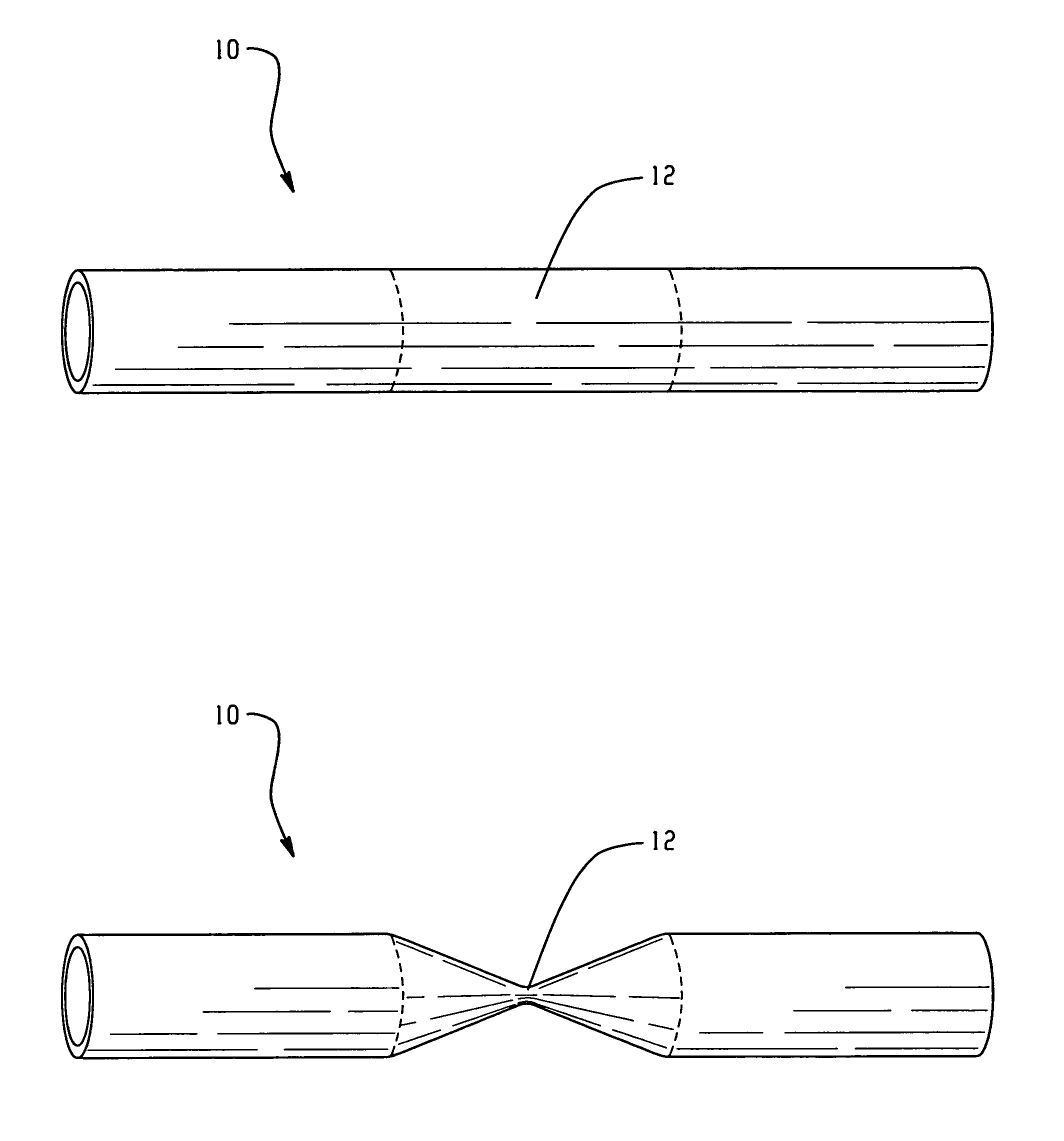 Shape memory polymer conduits and methods of use