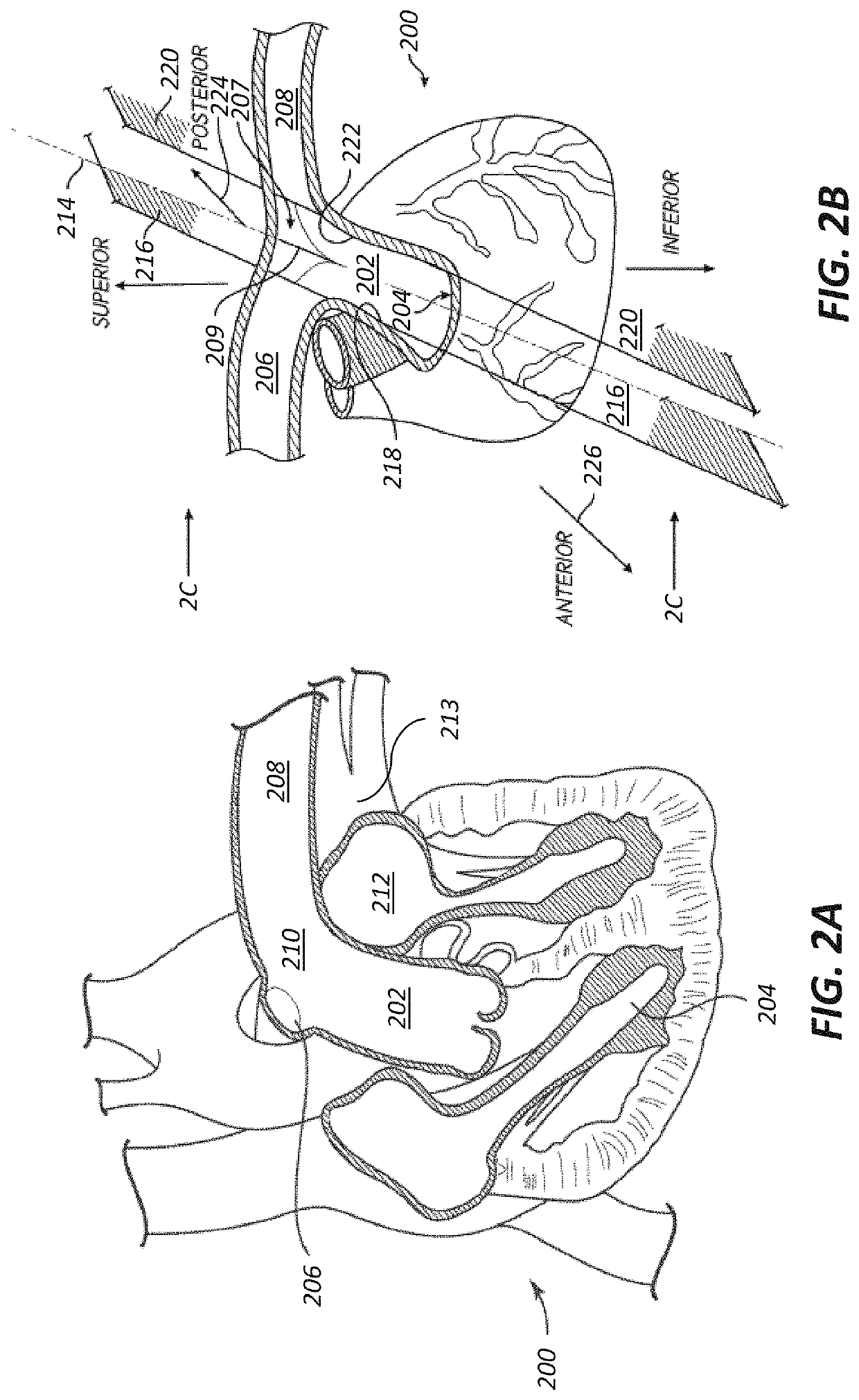 Neurostimulation systems and methods for affecting cardiac contractility