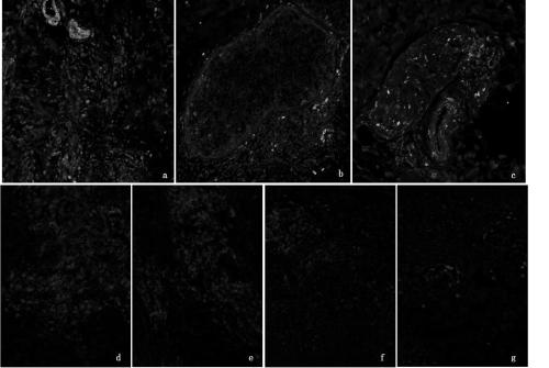 Skin tissue immune cell in-situ detection kit for lupus erythematosus typing and application thereof