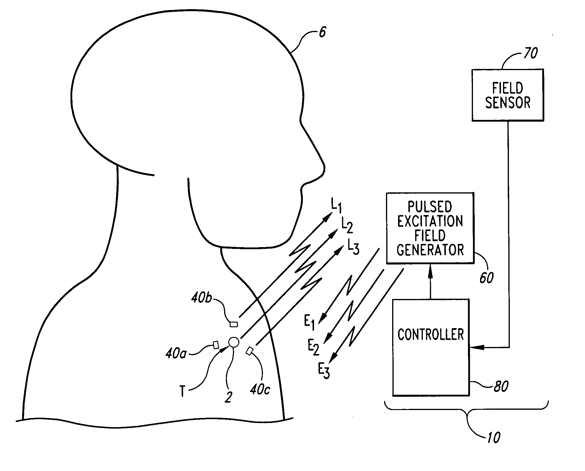 Systems and methods for real time tracking of targets in radiation therapy and other medical applications