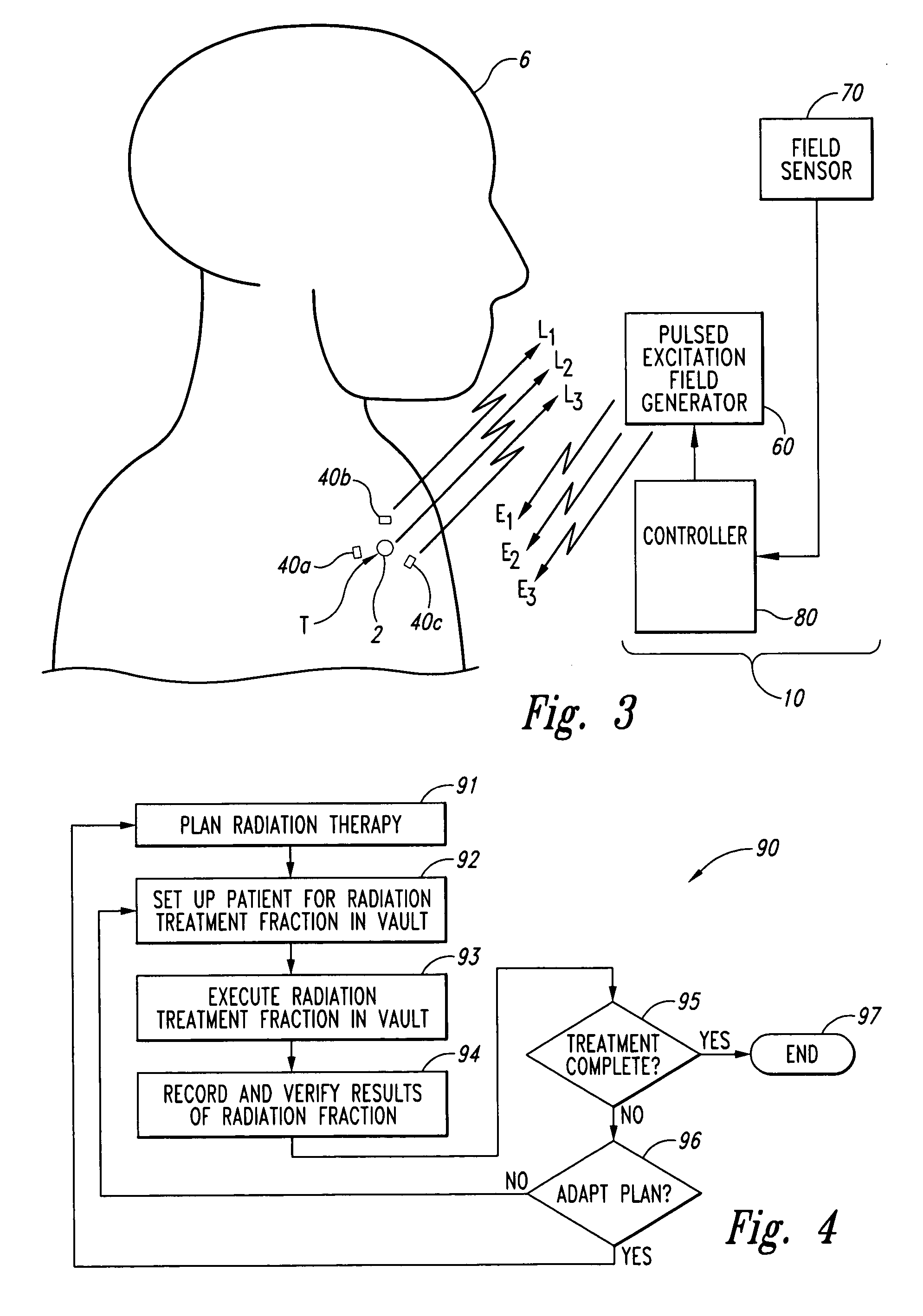 Systems and methods for real time tracking of targets in radiation therapy and other medical applications