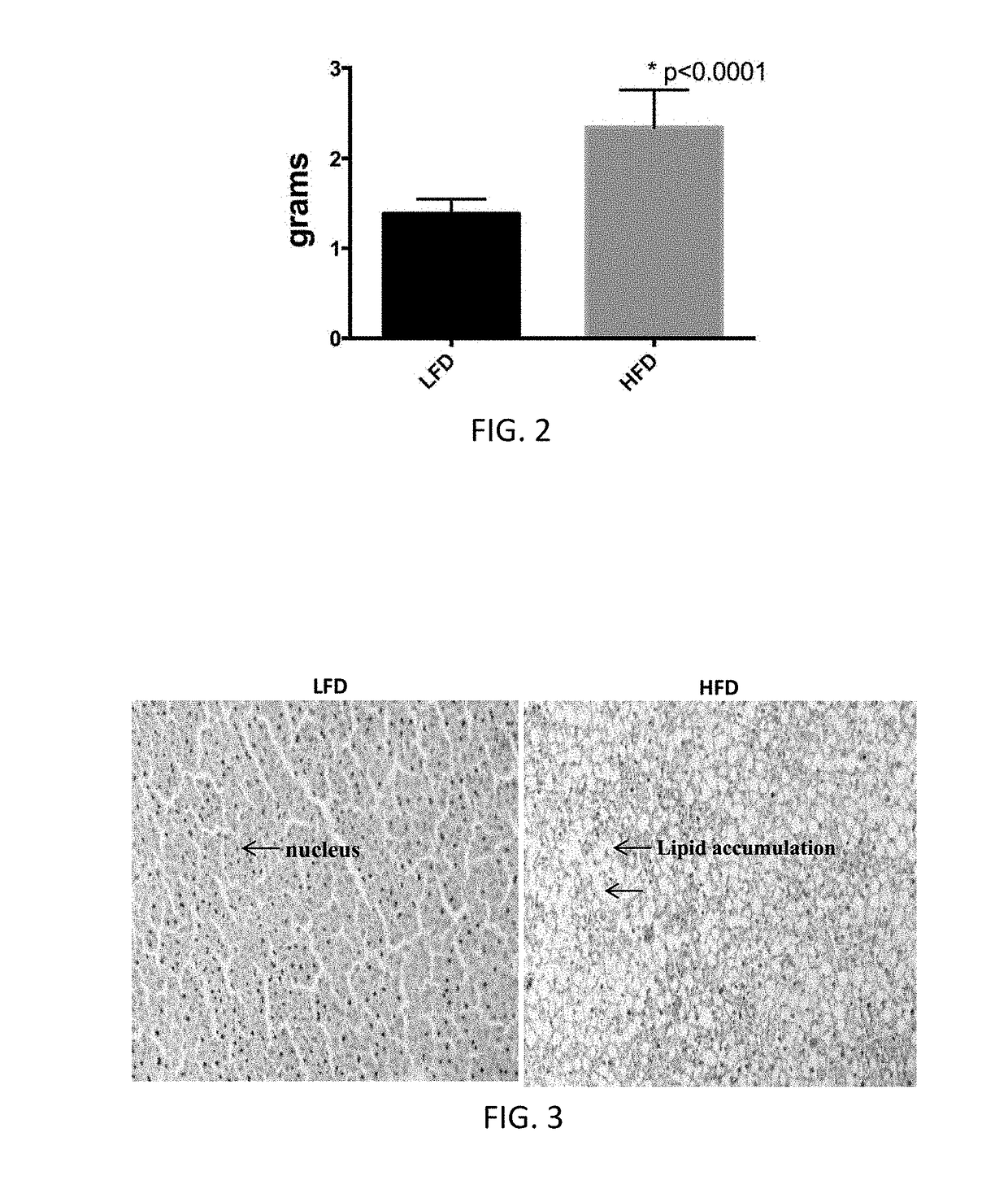 Compositions and methods for the reduction or prevention of non-alcoholic steatohepatitis (NASH)