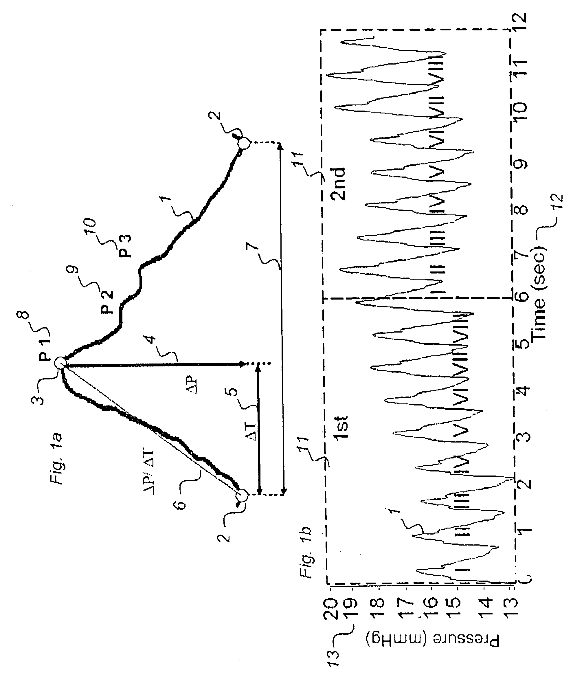 Method for analysis of single pulse pressure waves