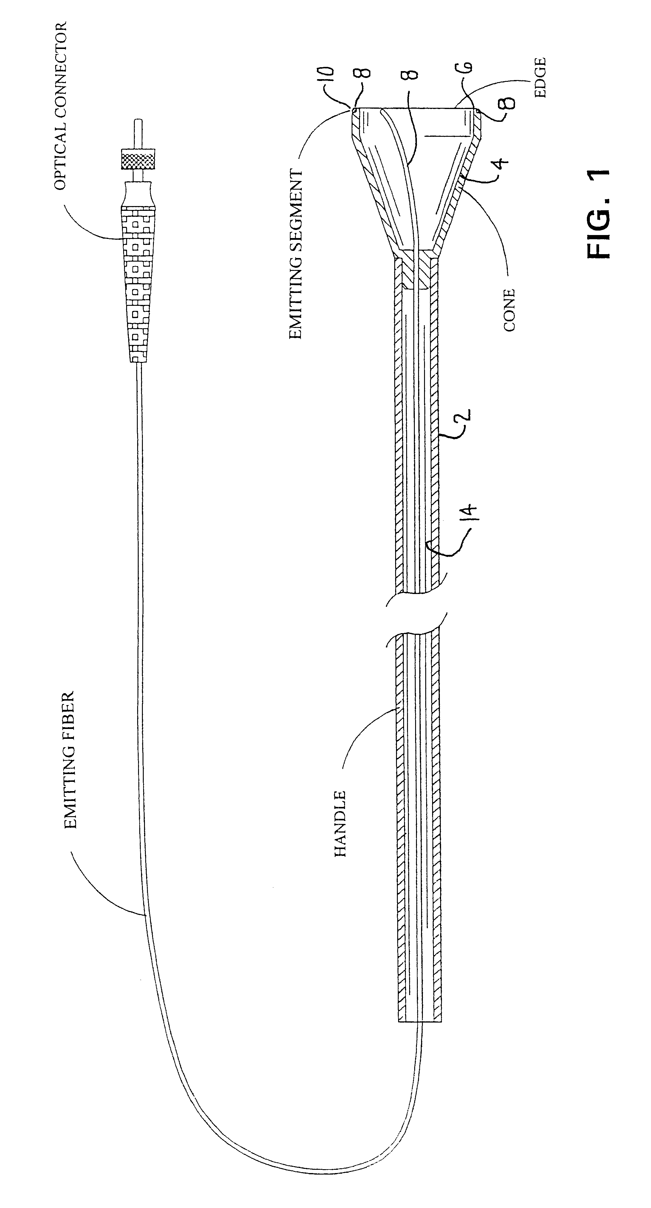 Circumferential transillumination of anatomic junctions using light energy