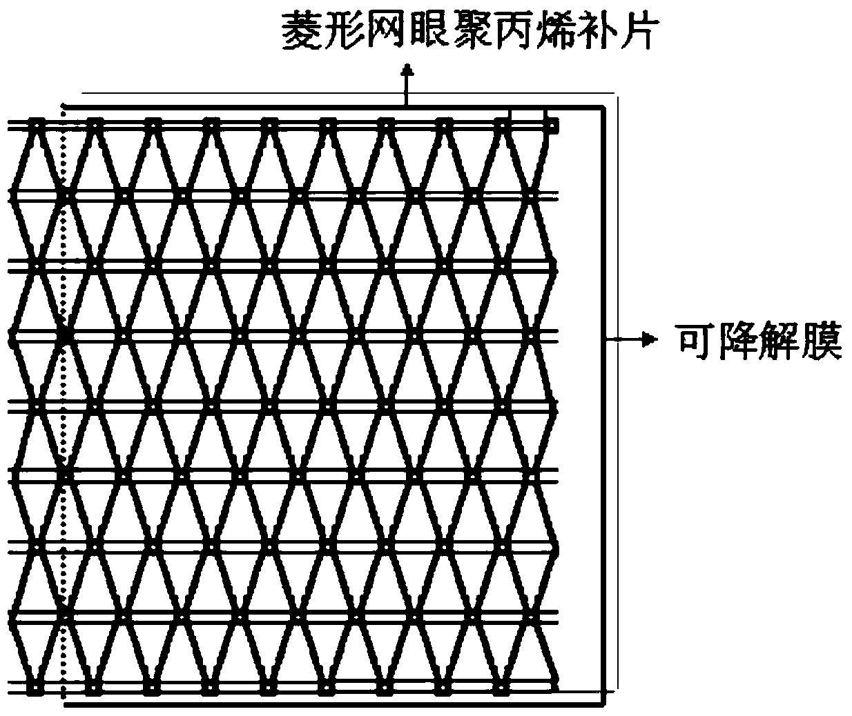 A kind of polylactic acid/polycaprolactone/polypropylene composite pelvic floor patch and preparation method thereof