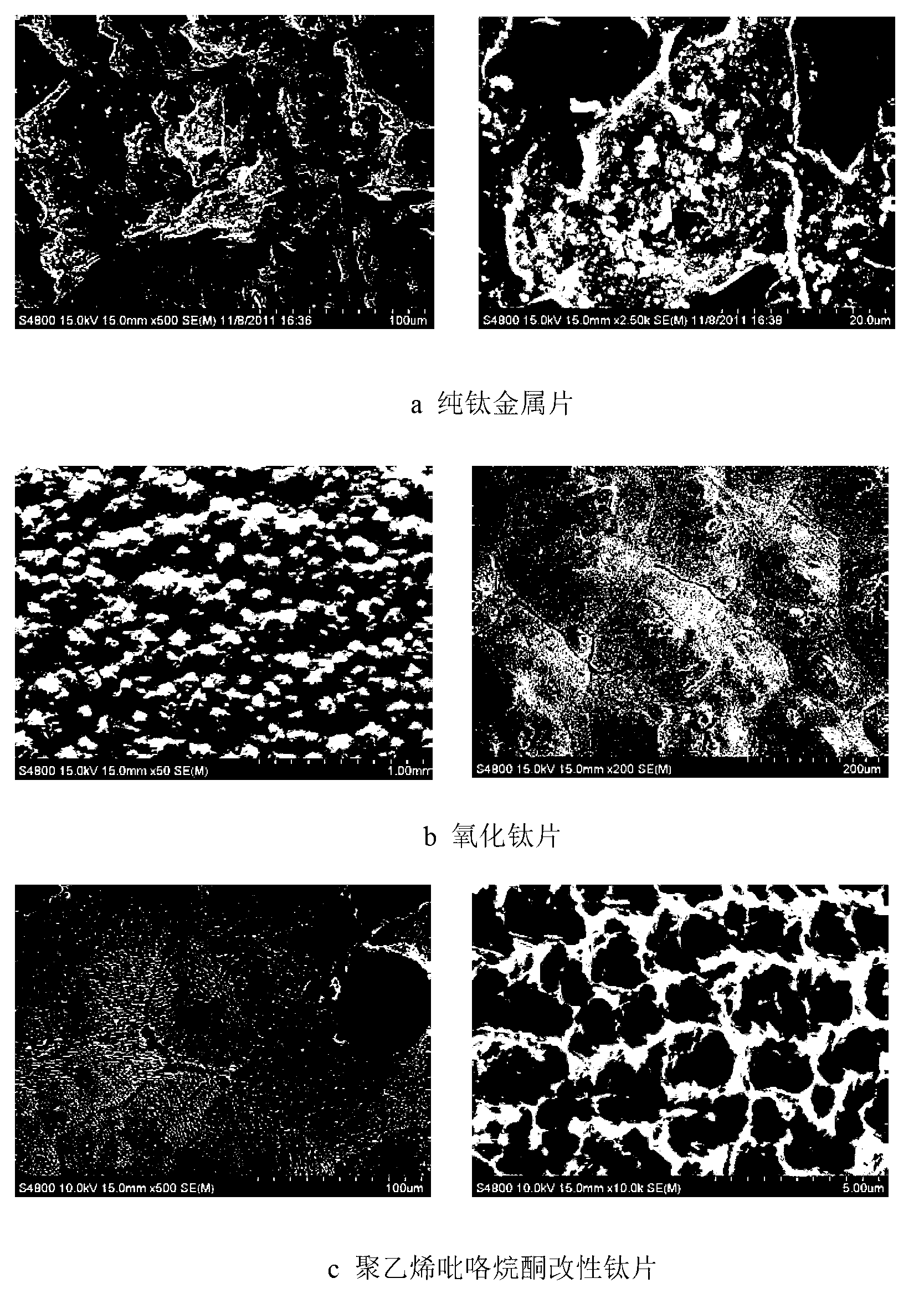 Surface modified medical metal material and preparation method thereof