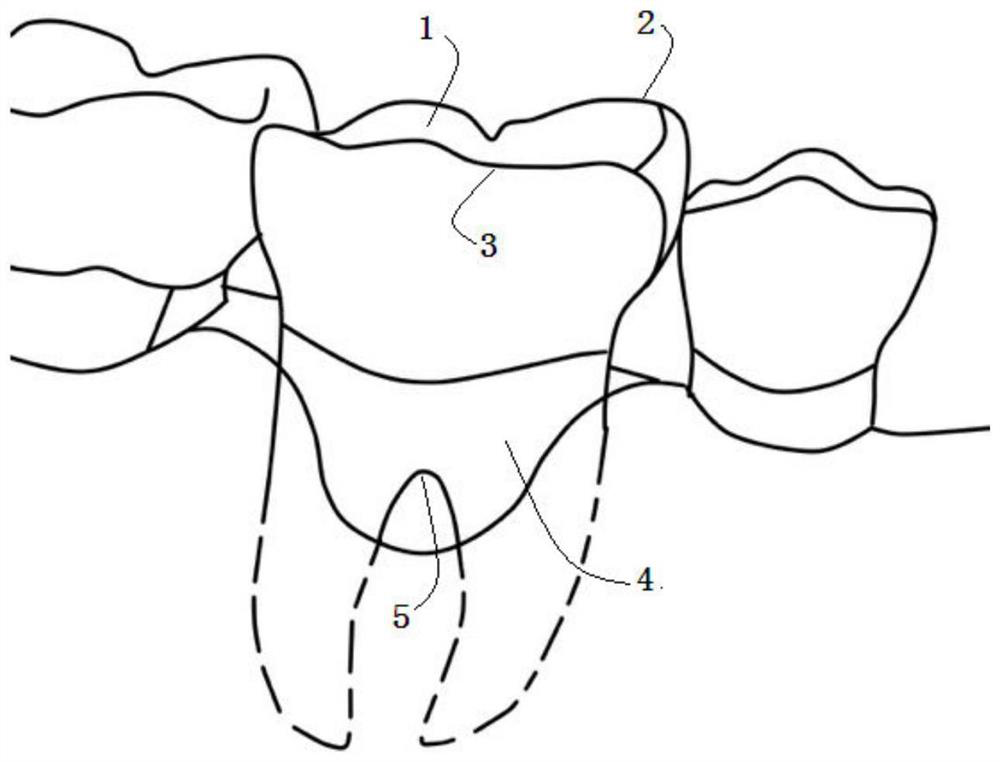 A method of 3D printing personalized periodontal tissue regeneration materials