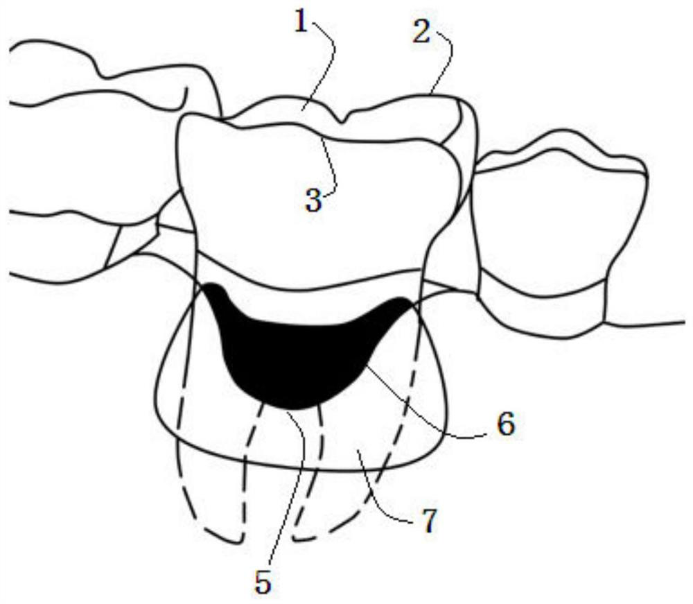 A method of 3D printing personalized periodontal tissue regeneration materials