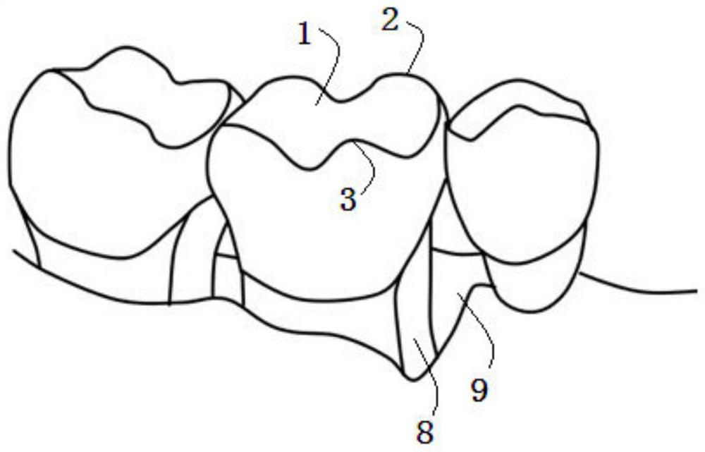 A method of 3D printing personalized periodontal tissue regeneration materials