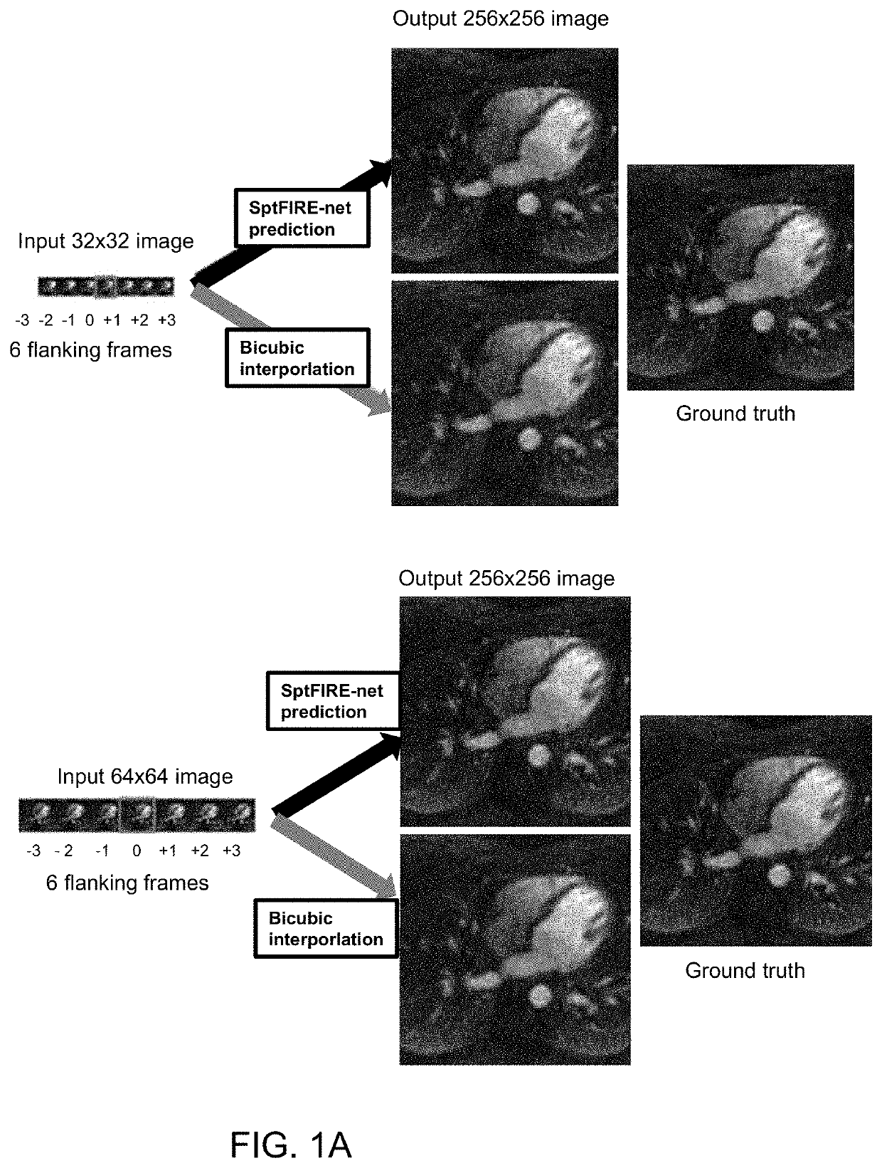 Spatiotemporal resolution enhancement of biomedical images