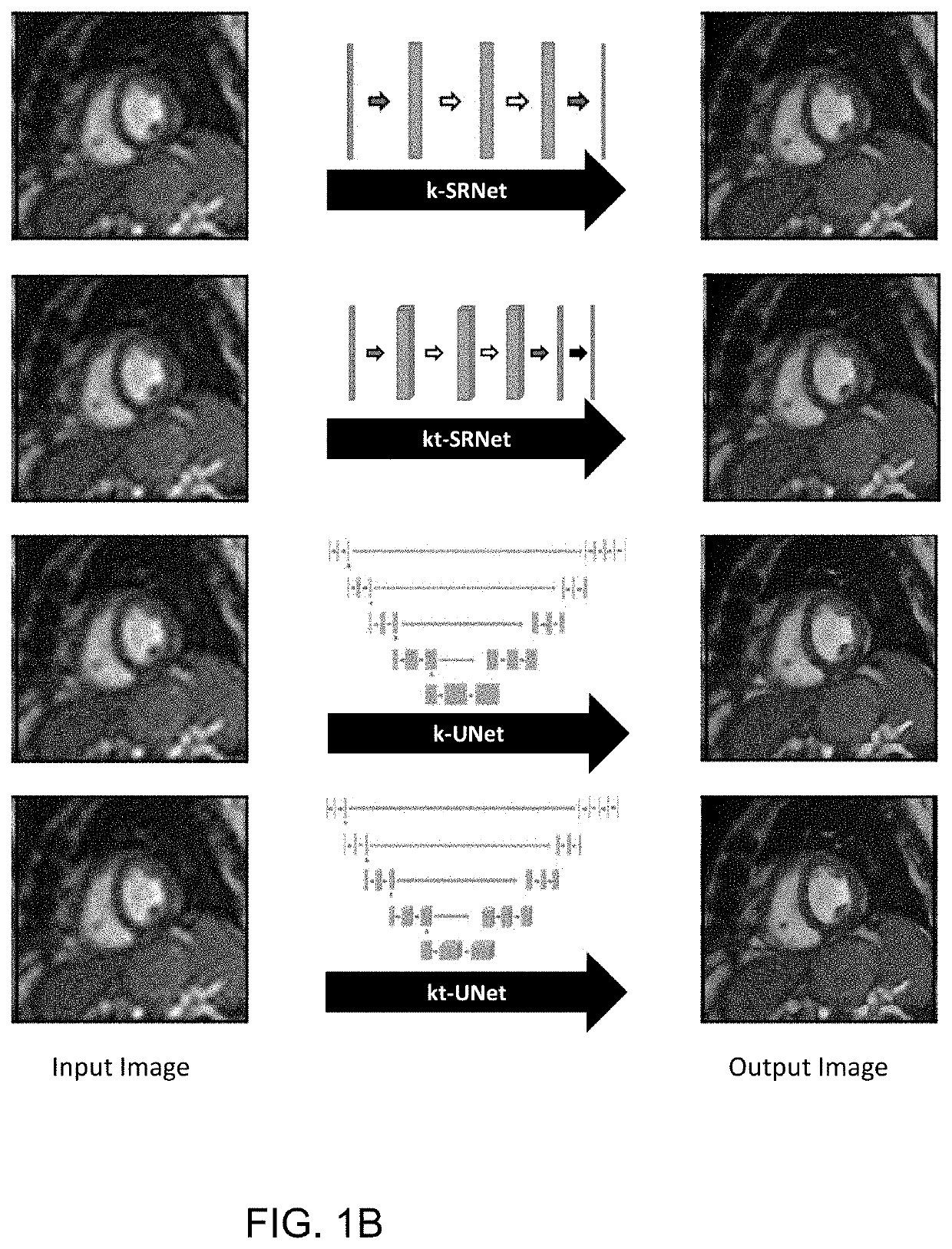 Spatiotemporal resolution enhancement of biomedical images